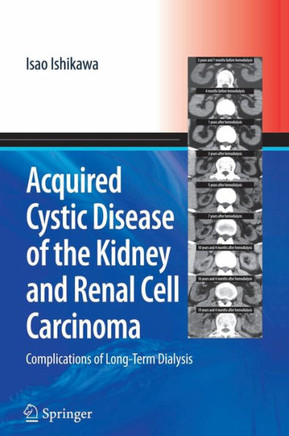 Acquired Cystic Disease of the Kidney and Renal Cell Carcinoma: Complication of Long-Term Dialysis