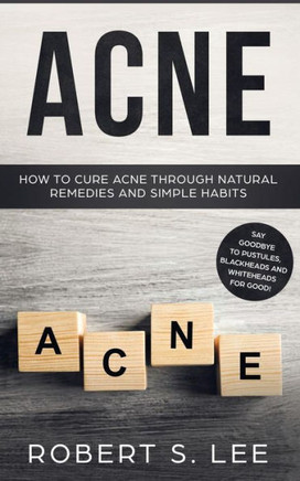 Acne: How To Cure Acne Through Natural Remedies And Simple Habits. Say Goodbye To Pustules, Blackheads And Whiteheads For Good!