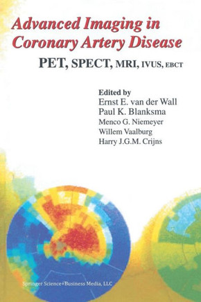 Advanced Imaging in Coronary Artery Disease: Pet, Spect, Mri, Ivus, Ebct