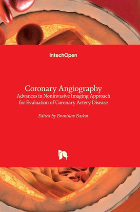 Coronary Angiography: Advances in Noninvasive Imaging Approach for Evaluation of Coronary Artery Disease