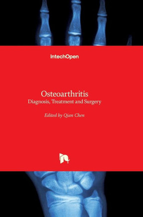 Osteoarthritis: Diagnosis, Treatment and Surgery