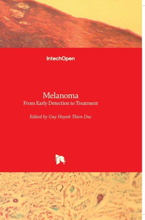 Melanoma: From Early Detection to Treatment
