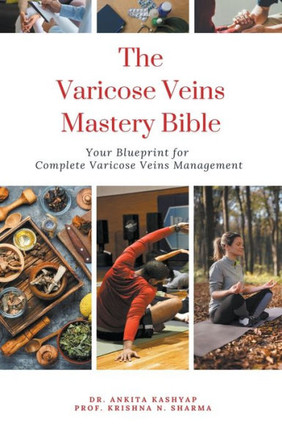 The Varicose Veins Mastery Bible: Your Blueprint for Complete Varicose Veins Management