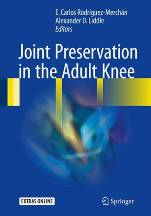 Joint Preservation in the Adult Knee