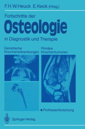 Fortschritte Der Osteologie in Diagnostik Und Therapie: Genetische Knochenerkrankungen Prim?re Knochentumoren - Prothesenforschung Osteologia 3