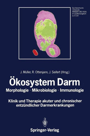 ?kosystem Darm: Morphologie, Mikrobiologie, Immunologie Klinik Und Therapie Akuter Und Chronischer Entz?ndlicher Darmerkrankungen