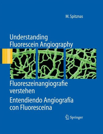 Understanding Fluorescein Angiography, Fluoreszeinangiografie Verstehen, Entendiendo Angiograf?a Con Fluoresce?na