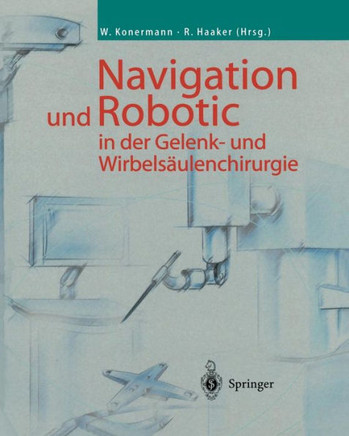 Navigation Und Robotic in Der Gelenk- Und Wirbels?ulenchirurgie
