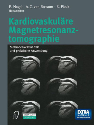 Kardiovaskul?re Magnetresonanztomographie: Methodenverst?ndnis Und Praktische Anwendung