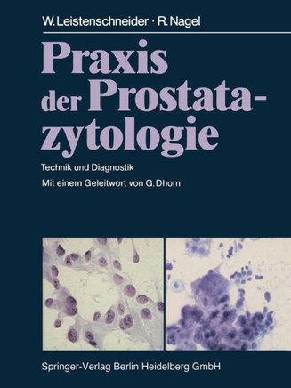 PRAXIS Der Prostatazytologie: Technik Und Diagnostik