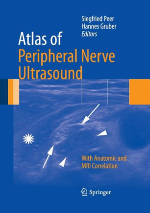 Atlas of Peripheral Nerve Ultrasound: With Anatomic and MRI Correlation