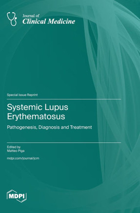 Systemic Lupus Erythematosus: Pathogenesis, Diagnosis and Treatment