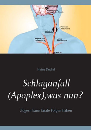 Schlaganfall (Apoplex), was nun?: Z?gern kann fatale Folgen haben