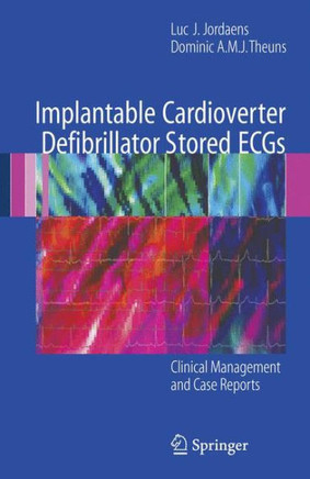 Implantable Cardioverter Defibrillator Stored ECGs: Clinical Management and Case Reports