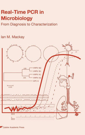 Real-Time PCR in Microbiology: From Diagnosis to Characterisation