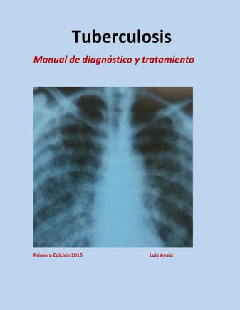Tratamiento de Tuberculosis: Manual de diagn?stico y tratamiento