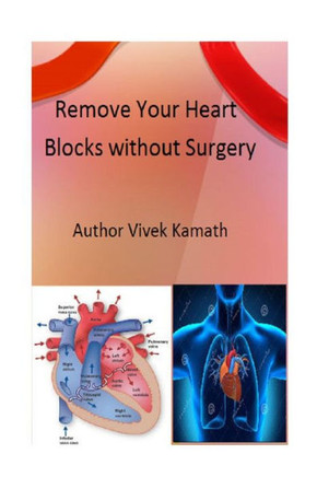 Remove Your Heart Blocks Without Surgery