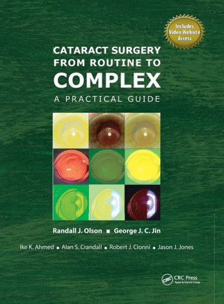Cataract Surgery from Routine to Complex: A Practical Guide