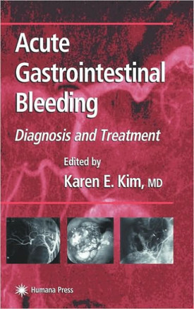 Acute Gastrointestinal Bleeding: Diagnosis and Treatment