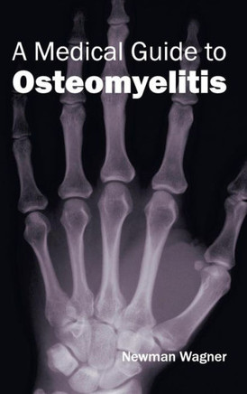 Medical Guide to Osteomyelitis Medical Guide to Osteomyelitis