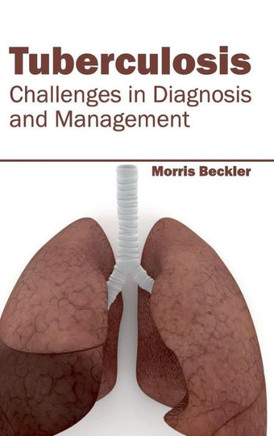 Tuberculosis: Challenges in Diagnosis and Management