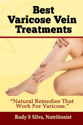 Best Varicose Vein Treatments: Natural Remedies That Work for Varicose - Large Print