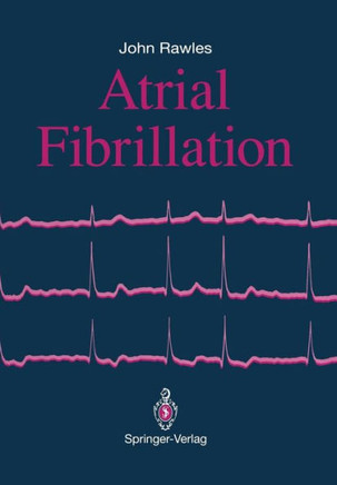 Atrial Fibrillation