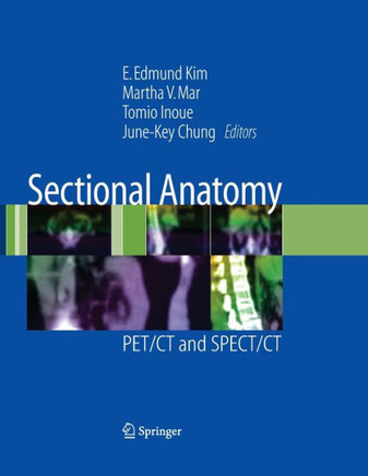 Sectional Anatomy: PET/CT and SPECT/CT