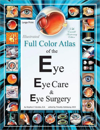 Illustrated Full Color Atlas of the Eye, Eye Care, and Eye Surgery - LARGE PRINT Edition - Large Print