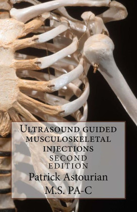 Ultrasound guided musculoskeletal injections