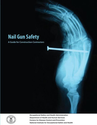 Nail Gun Safety: A Guide for Construction Contractors