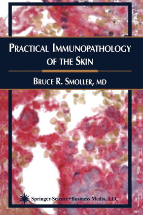 Practical Immunopathology of the Skin