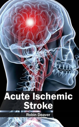 Acute Ischemic Stroke