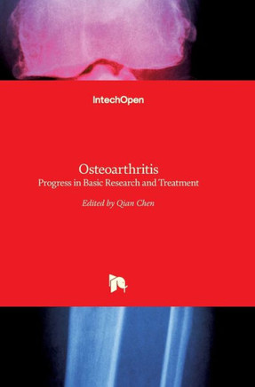 Osteoarthritis : Progress in Basic Research and Treatment