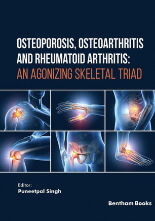 Osteoporosis, Osteoarthritis and Rheumatoid Arthritis : An Agonizing Skeletal Triad