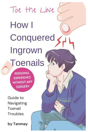 Cure Ingrown Toenails : My Personal Story of Achieving Pain-Free Toes Without Surgery: Toe the Line: How I Conquered Ingrown Toenails Without Surgery