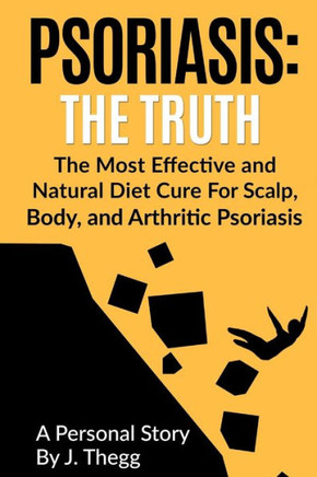Psoriasis: The Truth: The Most Effective And Natural Diet Cure For Scalp, Body, And Arthritic Psoriasis (Psoriasis Treatment Psoriasis Shampoo Psoriasis Cream Psoriasis Lotion)