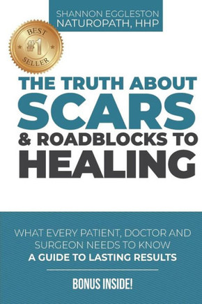The Truth About Scars And Roadblocks To Healing : What Every Patient, Doctor, And Surgeon Needs To Know