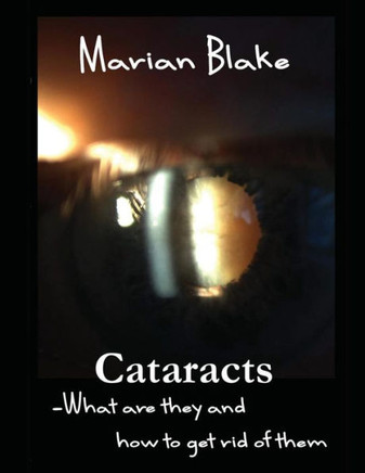 Cataracts: What Are They And How To Get Rid Of Them? (Your Eyes)