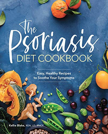 The Psoriasis Diet Cookbook: Easy, Healthy Recipes To Soothe Your Symptoms