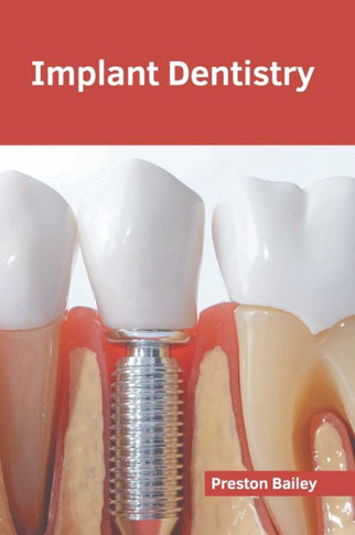 Implant Dentistry