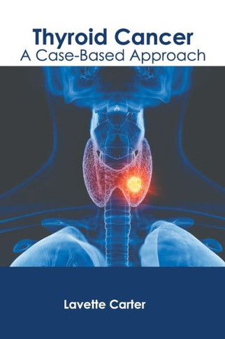 Thyroid Cancer: A Case-Based Approach