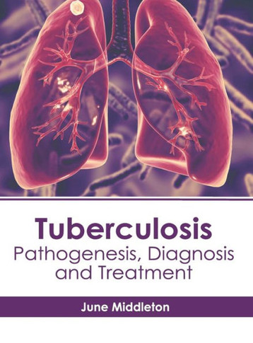 Tuberculosis: Pathogenesis, Diagnosis and Treatment