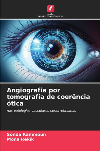 Angiografia por tomografia de coerência ótica