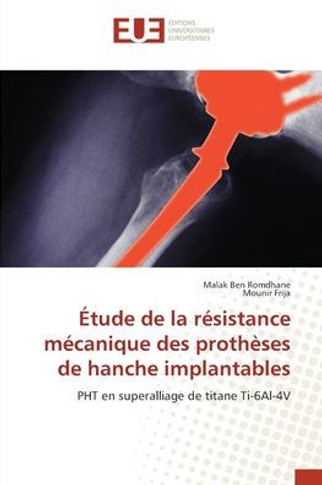 Étude de la résistance mécanique des prothèses de hanche implantables