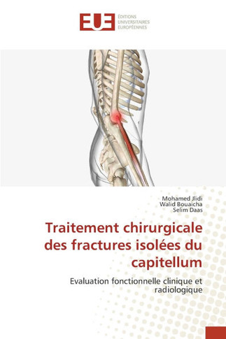 Traitement chirurgicale des fractures isol?s du capitellum