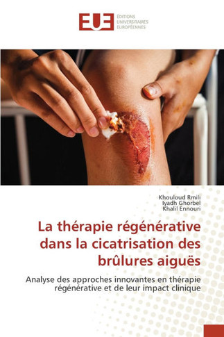 La th?apie r???ative dans la cicatrisation des br?ures aigu?