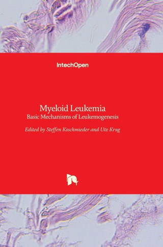 Myeloid Leukemia: Basic Mechanisms of Leukemogenesis