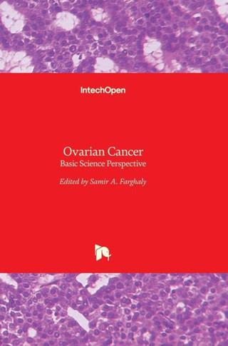 Ovarian Cancer: Basic Science Perspective