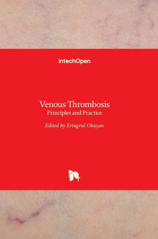 Venous Thrombosis: Principles and Practice